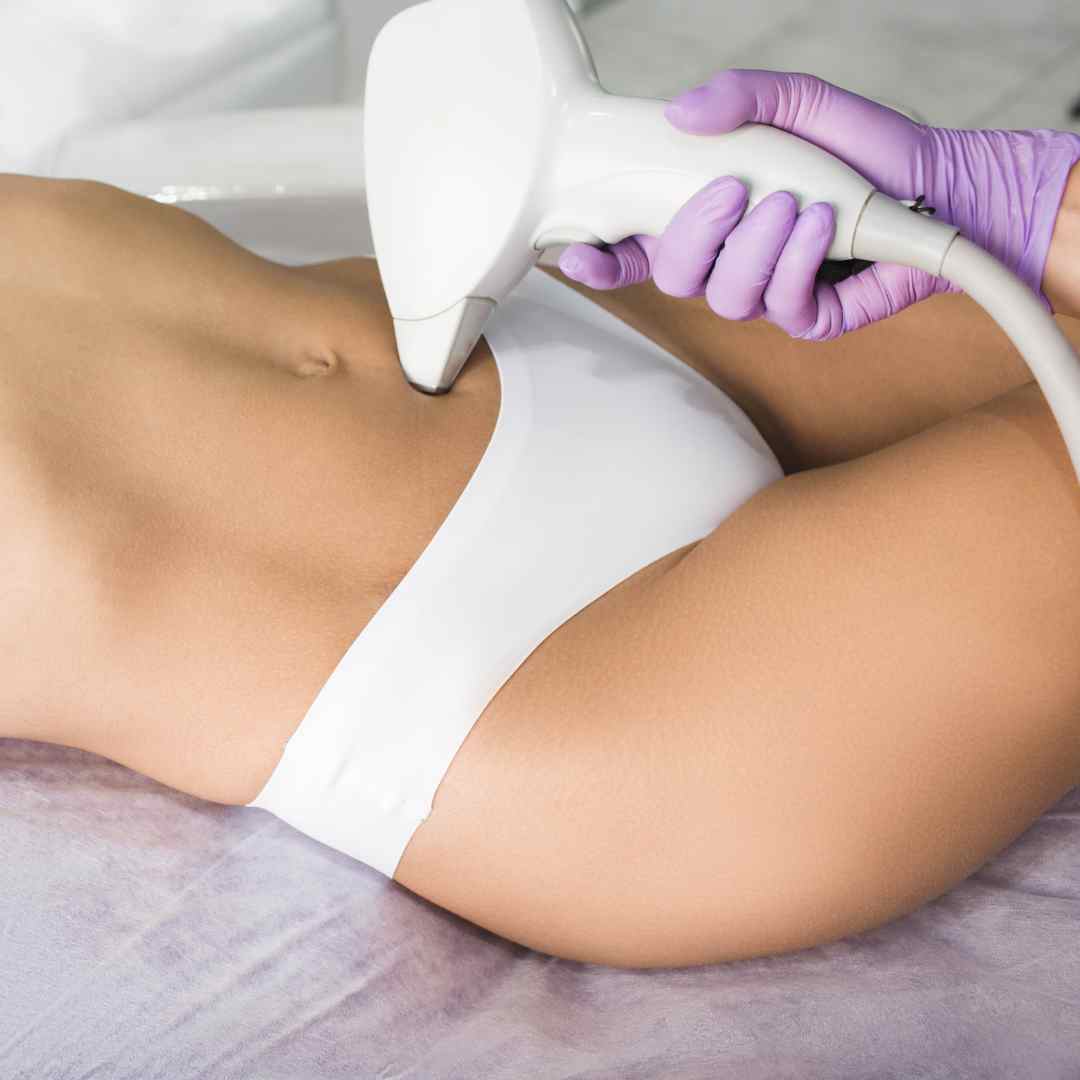 Depilación Láser para mujeres